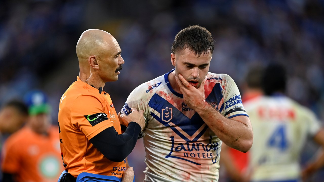 Bulldogs Injury Update | Bulldogs